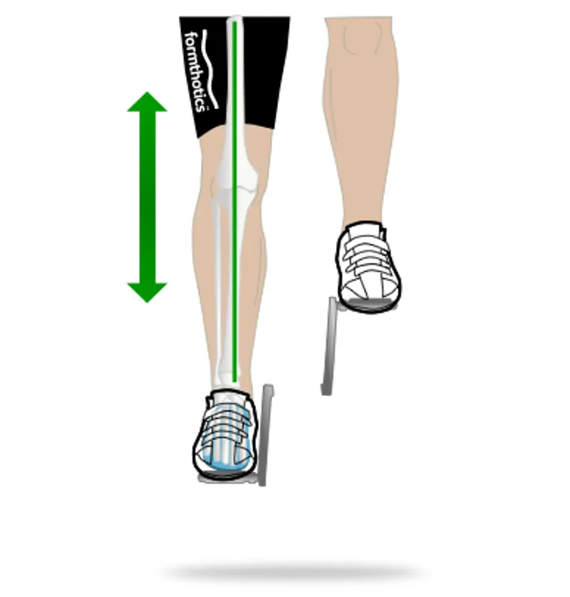 Leg - Foot Alignment