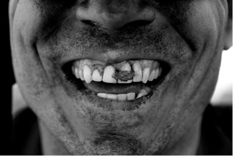 Genetic Carbon Micro Fender-2